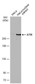 ATM Antibody in Western Blot (WB)