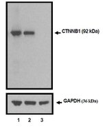 beta Catenin Antibody in Western Blot (WB)