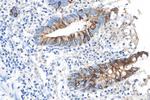 Cytokeratin 20 Antibody in Immunohistochemistry (Paraffin) (IHC (P))