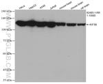 KIF5B Antibody in Western Blot (WB)