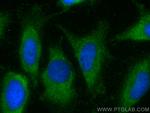 LASP1 Antibody in Immunocytochemistry (ICC/IF)