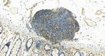 LASP1 Antibody in Immunohistochemistry (Paraffin) (IHC (P))