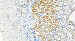 LASP1 Antibody in Immunohistochemistry (Paraffin) (IHC (P))