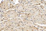 PTPN11 Antibody in Immunohistochemistry (Paraffin) (IHC (P))