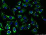 EIF3D Antibody in Immunocytochemistry (ICC/IF)