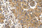 EIF3D Antibody in Immunohistochemistry (Paraffin) (IHC (P))
