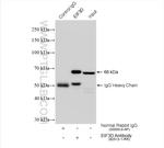 EIF3D Antibody in Immunoprecipitation (IP)