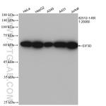EIF3D Antibody in Western Blot (WB)
