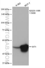 WT1 Antibody in Western Blot (WB)
