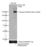 Phospho-PERK/EIF2AK3 (Thr982) Antibody in Western Blot (WB)