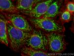 Tim23 Antibody in Immunocytochemistry (ICC/IF)