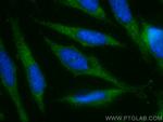 Stathmin 1 Antibody in Immunocytochemistry (ICC/IF)