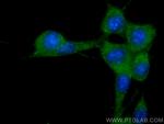 Stathmin 1 Antibody in Immunocytochemistry (ICC/IF)