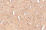 Stathmin 1 Antibody in Immunohistochemistry (Paraffin) (IHC (P))