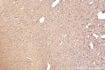 Stathmin 1 Antibody in Immunohistochemistry (Paraffin) (IHC (P))