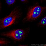 NAT10 Antibody in Immunocytochemistry (ICC/IF)