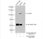 NAT10 Antibody in Immunoprecipitation (IP)