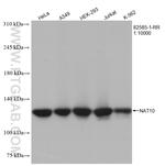 NAT10 Antibody in Western Blot (WB)