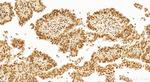 Glucocorticoid receptor Antibody in Immunohistochemistry (Paraffin) (IHC (P))