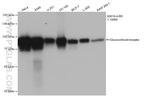 Glucocorticoid receptor Antibody in Western Blot (WB)