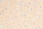 GCLM Antibody in Immunohistochemistry (Paraffin) (IHC (P))