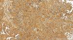 GCLM Antibody in Immunohistochemistry (Paraffin) (IHC (P))