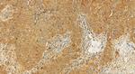 GCLM Antibody in Immunohistochemistry (Paraffin) (IHC (P))