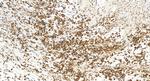 VDAC3 Antibody in Immunohistochemistry (Paraffin) (IHC (P))