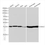 VDAC3 Antibody in Western Blot (WB)