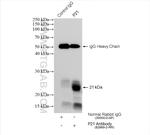 P21 Antibody in Immunoprecipitation (IP)