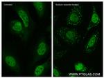 TIA1 Antibody in Immunocytochemistry (ICC/IF)