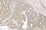 MFN2 Antibody in Immunohistochemistry (Paraffin) (IHC (P))