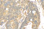 MFN2 Antibody in Immunohistochemistry (Paraffin) (IHC (P))