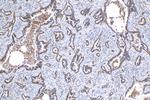 MX1 Antibody in Immunohistochemistry (Paraffin) (IHC (P))