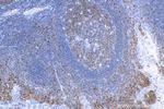MX1 Antibody in Immunohistochemistry (Paraffin) (IHC (P))