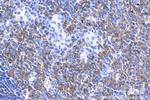 MX1 Antibody in Immunohistochemistry (Paraffin) (IHC (P))