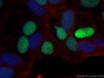 Cyclin D1 Recombinant Rabbit Monoclonal Antibody (6B10)