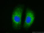 MCL1 Antibody in Immunocytochemistry (ICC/IF)