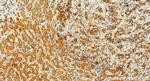 MCL1 Antibody in Immunohistochemistry (Paraffin) (IHC (P))