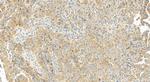 MCL1 Antibody in Immunohistochemistry (Paraffin) (IHC (P))