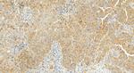 MCL1 Antibody in Immunohistochemistry (Paraffin) (IHC (P))
