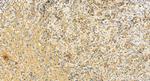 MCL1 Antibody in Immunohistochemistry (Paraffin) (IHC (P))