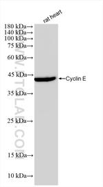 Cyclin E Antibody in Western Blot (WB)