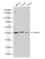 Cyclin E Antibody in Western Blot (WB)