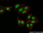 Cyclin E Antibody in Immunocytochemistry (ICC/IF)