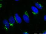 GOLGA2/GM130 Antibody in Immunocytochemistry (ICC/IF)