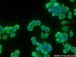 FGF-21 Antibody in Immunocytochemistry (ICC/IF)