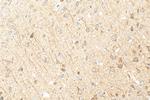 Cleaved Caspase 3 Antibody in Immunohistochemistry (Paraffin) (IHC (P))