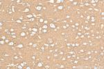 NCAM1/CD56 Antibody in Immunohistochemistry (Paraffin) (IHC (P))