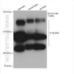 NCAM1/CD56 Antibody in Western Blot (WB)